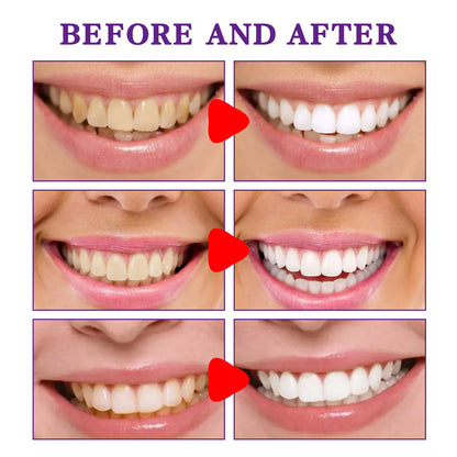Purple Teeth Whitening Cleanser